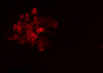 PPFIBP1 Antibody - Staining A549 cells by IF/ICC. The samples were fixed with PFA and permeabilized in 0.1% Triton X-100, then blocked in 10% serum for 45 min at 25°C. The primary antibody was diluted at 1:200 and incubated with the sample for 1 hour at 37°C. An Alexa Fluor 594 conjugated goat anti-rabbit IgG (H+L) antibody, diluted at 1/600, was used as secondary antibody.