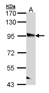 PPFIBP2 Antibody - Sample (30 ug of whole cell lysate). A: A431 . 7.5% SDS PAGE. PPFIBP2 antibody diluted at 1:1000.