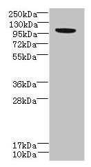 PPFIBP2 Antibody - Western blot All lanes: PPFIBP2 antibody at 6µg/ml + HepG2 whole cell lysate Secondary Goat polyclonal to rabbit IgG at 1/10000 dilution Predicted band size: 99, 87, 84 kDa Observed band size: 99 kDa
