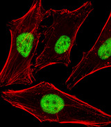 PPHLN1 Antibody - Fluorescent image of HeLa cells stained with PPHLN1 Antibody. Antibody was diluted at 1:25 dilution. An Alexa Fluor 488-conjugated goat anti-rabbit lgG at 1:400 dilution was used as the secondary antibody (green). Cytoplasmic actin was counterstained with Alexa Fluor 555 conjugated with Phalloidin (red).