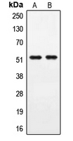 PPHLN1 Antibody - Western blot analysis of PPHLN1 expression in A549 (A); COLO205 (B) whole cell lysates.