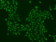PPHLN1 Antibody - Immunofluorescence staining of PPHLN1 in A431 cells. Cells were fixed with 4% PFA, permeabilzed with 0.1% Triton X-100 in PBS, blocked with 10% serum, and incubated with rabbit anti-Human PPHLN1 polyclonal antibody (dilution ratio 1:1000) at 4°C overnight. Then cells were stained with the Alexa Fluor 488-conjugated Goat Anti-rabbit IgG secondary antibody (green). Positive staining was localized to Nucleus.
