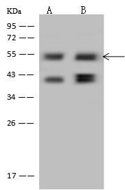 PPHLN1 Antibody - Anti-PPHLN1 rabbit polyclonal antibody at 1:500 dilution. Lane A: 293 Whole Cell Lysate. Lane B: U-251 MG Whole Cell Lysate. Lysates/proteins at 30 ug per lane. Secondary: Goat Anti-Rabbit IgG (H+L)/HRP at 1/10000 dilution. Developed using the ECL technique. Performed under reducing conditions. Predicted band size: 53 kDa. Observed band size: 53 kDa.