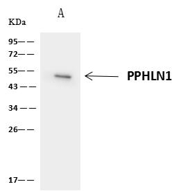 PPHLN1 Antibody - PPHLN1 was immunoprecipitated using: Lane A: 0.5 mg 293 Whole Cell Lysate. 1 uL anti-PPHLN1 rabbit polyclonal antibody and 60 ug of Immunomagnetic beads Protein A/G. Primary antibody: Anti-PPHLN1 rabbit polyclonal antibody, at 1:500 dilution. Secondary antibody: Clean-Blot IP Detection Reagent (HRP) at 1:1000 dilution. Developed using the ECL technique. Performed under reducing conditions. Predicted band size: 53 kDa. Observed band size: 55 kDa.