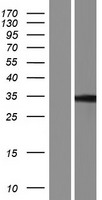PPHLN1 Protein - Western validation with an anti-DDK antibody * L: Control HEK293 lysate R: Over-expression lysate