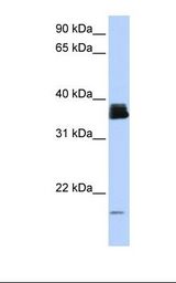 PPIA / Cyclophilin A Antibody - Fetal brain lysate. Antibody concentration: 1.0 ug/ml. Gel concentration: 12%.  This image was taken for the unconjugated form of this product. Other forms have not been tested.