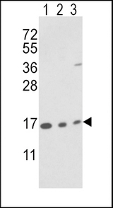 PPIA / Cyclophilin A Antibody - Western blot of PPIA Antibody in T47D cell line(lane 1) and mouse brain(lane 2),bladder(lane 3) tissue lysates (35 ug/lane). PPIA (arrow) was detected using the purified antibody.(2 ug/ml)