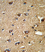 PPIA / Cyclophilin A Antibody - Formalin-fixed and paraffin-embedded human brain tissue reacted with PPIA Antibody , which was peroxidase-conjugated to the secondary antibody, followed by DAB staining. This data demonstrates the use of this antibody for immunohistochemistry; clinical relevance has not been evaluated.