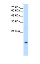 PPIA / Cyclophilin A Antibody - HepG2 cell lysate. Antibody concentration: 2.5 ug/ml. Gel concentration: 15%.  This image was taken for the unconjugated form of this product. Other forms have not been tested.