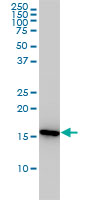PPIA / Cyclophilin A Antibody - PPIA monoclonal antibody (M01), clone 1F4-1B5 Western Blot analysis of PPIA expression in Jurkat.