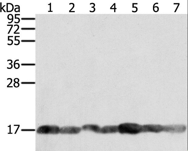 PPIA / Cyclophilin A Antibody - Western blot analysis of PC3, Raji, NIH/3T3, K562, HeLa, hepg2 and Jurkat cell, using PPIA Polyclonal Antibody at dilution of 1:400.