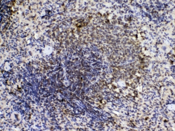 PPIA / Cyclophilin A Antibody - IHC testing of FFPE mouse intestine tissue with Cyclophilin A antibody at 1ug/ml. Required HIER: steam section in pH6 citrate buffer for 20 min and allow to cool prior to testing.