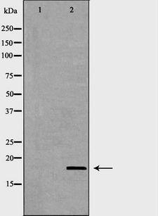 PPIA / Cyclophilin A Antibody - Western blot analysis of HeLa whole cells lysates using PPIA antibody. The lane on the left is treated with the antigen-specific peptide.