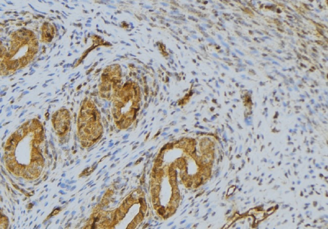 PPIA / Cyclophilin A Antibody - 1:100 staining human uterus tissue by IHC-P. The sample was formaldehyde fixed and a heat mediated antigen retrieval step in citrate buffer was performed. The sample was then blocked and incubated with the antibody for 1.5 hours at 22°C. An HRP conjugated goat anti-rabbit antibody was used as the secondary.