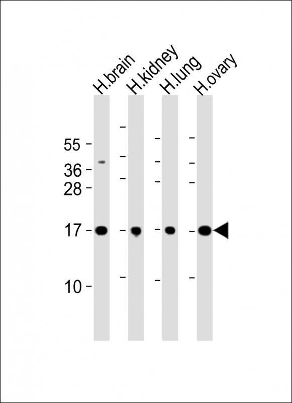 PPIAL4A Antibody - All lanes: Anti-PPIAL4A Antibody (Center) at 1:2000 dilution Lane 1: human brain lysate Lane 2: human kidney lysate Lane 3: human lung lysate Lane 4: human ovary lysate Lysates/proteins at 20 µg per lane. Secondary Goat Anti-Rabbit IgG, (H+L), Peroxidase conjugated at 1/10000 dilution. Predicted band size: 18 kDa Blocking/Dilution buffer: 5% NFDM/TBST.