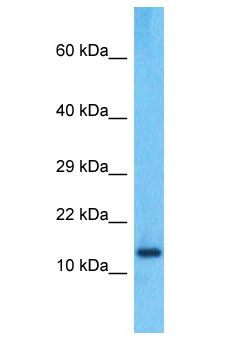 PPIAL4C Antibody - PPIAL4C antibody Western Blot of A549. Antibody dilution: 1 ug/ml.  This image was taken for the unconjugated form of this product. Other forms have not been tested.
