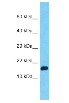 PPIAL4G Antibody - PPIAL4G antibody Western Blot of HepG2. Antibody dilution: 1 ug/ml.  This image was taken for the unconjugated form of this product. Other forms have not been tested.