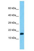 PPIAL4G Antibody - PPIAL4G antibody Western Blot of HepG2. Antibody dilution: 1 ug/ml.  This image was taken for the unconjugated form of this product. Other forms have not been tested.