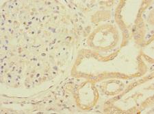 PPIAL4G Antibody - Immunohistochemistry of paraffin-embedded human kidney tissue using PPIAL4G Antibody at dilution of 1:100