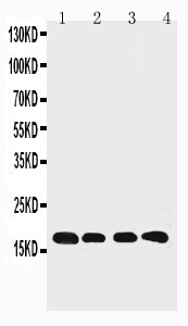 PPIB / Cyclophilin B Antibody - WB of PPIB / Cyclophilin B antibody. Lane 1: Rat Ovary Tissue Lysate. Lane 2: HELA Cell Lysate. Lane 3: 293T Cell Lysate. Lane 4: A431 Cell Lysate.