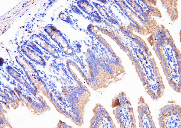 PPIB / Cyclophilin B Antibody - IHC analysis of Cyclophilin B/PPIB using anti-Cyclophilin B/PPIB antibody. Cyclophilin B/PPIB was detected in paraffin-embedded section of mouse intestine tissues. Heat mediated antigen retrieval was performed in citrate buffer (pH6, epitope retrieval solution) for 20 mins. The tissue section was blocked with 10% goat serum. The tissue section was then incubated with 1µg/ml rabbit anti-Cyclophilin B/PPIB Antibody overnight at 4°C. Biotinylated goat anti-rabbit IgG was used as secondary antibody and incubated for 30 minutes at 37°C. The tissue section was developed using Strepavidin-Biotin-Complex (SABC) with DAB as the chromogen.