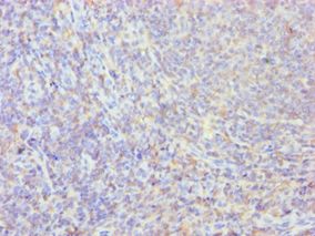 PPIB / Cyclophilin B Antibody - Immunohistochemistry of paraffin-embedded human tonsil using antibody at 1:100 dilution.