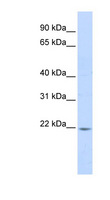 PPIB / Cyclophilin B Antibody - PPIB / Cyclophilin B antibody Western blot of Fetal Liver lysate. This image was taken for the unconjugated form of this product. Other forms have not been tested.