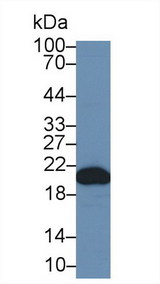 PPIB / Cyclophilin B Antibody - Western Blot; Sample: Human Liver lysate; Primary Ab: 1µg/ml Rabbit Anti-Human CYPB Antibody Second Ab: 0.2µg/mL HRP-Linked Caprine Anti-Rabbit IgG Polyclonal Antibody