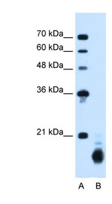 PPIB / Cyclophilin B Antibody - PPIB / Cyclophilin B antibody ARP44366_T100-NP_000933-PPIB(peptidylprolyl isomerase B (cyclophilin B)) Antibody Western blot of HepG2 cell lysate.  This image was taken for the unconjugated form of this product. Other forms have not been tested.