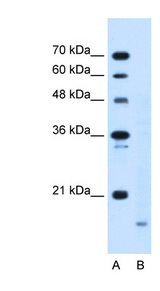PPIB / Cyclophilin B Antibody - PPIB / Cyclophilin B antibody ARP44365_T100-NP_000933-PPIB(peptidylprolyl isomerase B (cyclophilin B)) Antibody Western blot of HepG2 cell lysate.  This image was taken for the unconjugated form of this product. Other forms have not been tested.