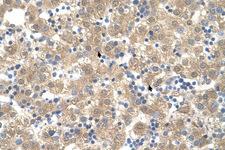 PPIB / Cyclophilin B Antibody - PPIB / Cyclophilin B antibody ARP44366_T100-NP_000933-PPIB(peptidylprolyl isomerase B (cyclophilin B)) Antibody IHC of formalin-fixed, paraffin-embedded human Liver. Positive label: Hepatocytes indicated with arrows. Antibody concentration 4-8 ug/ml. Magnification 400X.  This image was taken for the unconjugated form of this product. Other forms have not been tested.