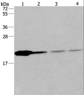 PPIB / Cyclophilin B Antibody - Western blot analysis of Human fetal liver tissue and 293T cell, human liver cancer tissue and HeLa cell, using PPIB Polyclonal Antibody at dilution of 1:500.