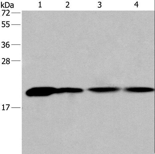 PPIB / Cyclophilin B Antibody - Western blot analysis of Human fetal liver tissue and 293T cell, human liver cancer tissue and HeLa cell, using PPIB Polyclonal Antibody at dilution of 1:450.