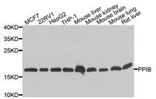 PPIB / Cyclophilin B Antibody - Western blot analysis of extracts of various cells.