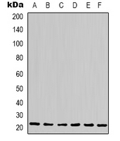 PPIB / Cyclophilin B Antibody - Western blot analysis of Cyclophilin B expression in HeLa (A); Jurkat (B); 293T (C); HepG2 (D); NIH3T3 (E); rat liver (F) whole cell lysates.