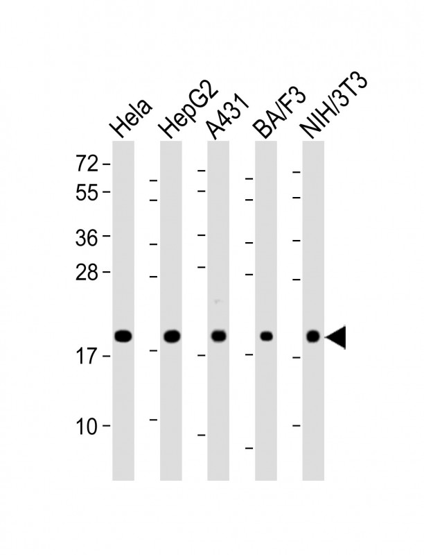 PPIB / Cyclophilin B Antibody - All lanes: Anti-Cyclophilin B Antibody at 1:2000 dilution Lane 1: Hela whole cell lysate Lane 2: HepG2 whole cell lysate Lane 3: A431 whole cell lysate Lane 4: BA/F3 whole cell lysate Lane 5: NIH/3T3 whole cell lysate Lysates/proteins at 20 µg per lane. Secondary Goat Anti-Rabbit IgG, (H+L), Peroxidase conjugated at 1/10000 dilution. Predicted band size: 24 kDa Blocking/Dilution buffer: 5% NFDM/TBST.