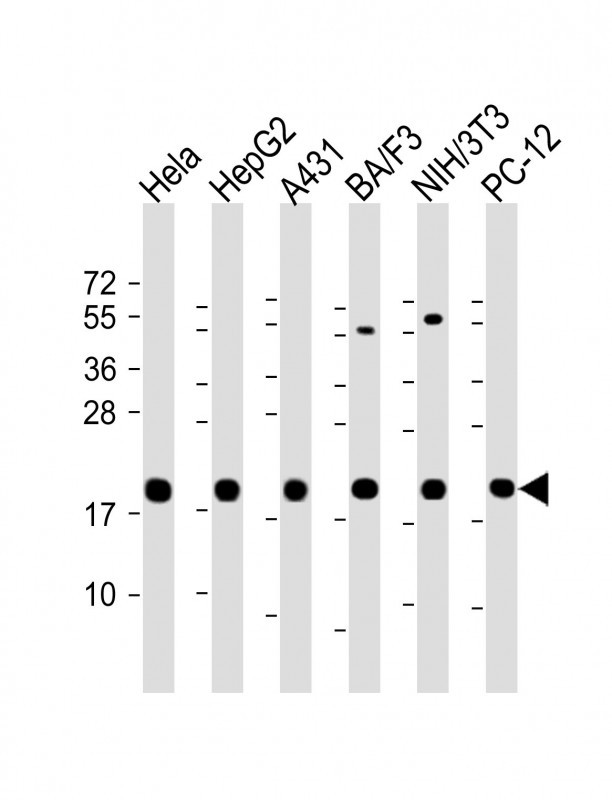 PPIB / Cyclophilin B Antibody - All lanes: Anti-Cyclophilin B Antibody at 1:2000 dilution Lane 1: Hela whole cell lysate Lane 2: HepG2 whole cell lysate Lane 3: A431 whole cell lysate Lane 4: BA/F3 whole cell lysate Lane 5: NIH/3T3 whole cell lysate lane 6: PC-12 whole cell lysate Lysates/proteins at 20 µg per lane. Secondary Goat Anti-Rabbit IgG, (H+L), Peroxidase conjugated at 1/10000 dilution. Predicted band size: 24 kDa Blocking/Dilution buffer: 5% NFDM/TBST.
