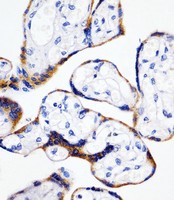 PPIB / Cyclophilin B Antibody - Cyclophilin B Antibody staining Cyclophilin B in human placenta tissue sections by Immunohistochemistry (IHC-P - paraformaldehyde-fixed, paraffin-embedded sections). Tissue was fixed with formaldehyde and blocked with 3% BSA for 0. 5 hour at room temperature; antigen retrieval was by heat mediation with a citrate buffer (pH6). Samples were incubated with primary antibody (1/25) for 1 hours at 37°C. A undiluted biotinylated goat polyvalent antibody was used as the secondary antibody.