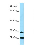 PPIC / Cyclophilin C Antibody - PPIC antibody Western blot of Small Intestine lysate. Antibody concentration 1 ug/ml.  This image was taken for the unconjugated form of this product. Other forms have not been tested.