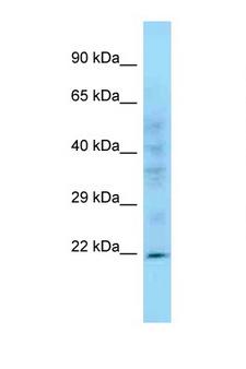 PPIC / Cyclophilin C Antibody - PPIC antibody Western blot of Mouse Heart lysate. Antibody concentration 1 ug/ml.  This image was taken for the unconjugated form of this product. Other forms have not been tested.
