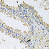 PPIC / Cyclophilin C Antibody - Immunohistochemistry of paraffin-embedded human prostate.