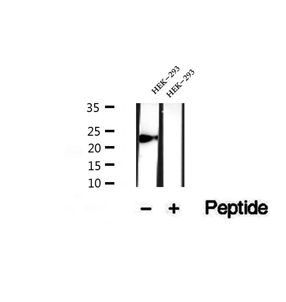 PPIC / Cyclophilin C Antibody - Western blot analysis of extracts of HEK293 cells using CYPC antibody.