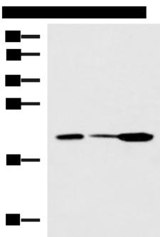 PPIC / Cyclophilin C Antibody - Western blot analysis of Mouse small intestines tissue Mouse kidney tissue Mouse pancreas tissue lysates  using PPIC Polyclonal Antibody at dilution of 1:550