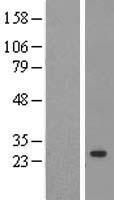 PPIC / Cyclophilin C Protein - Western validation with an anti-DDK antibody * L: Control HEK293 lysate R: Over-expression lysate