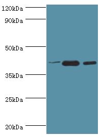 PPID / Cyclophilin D Antibody - Western blot. All lanes: Peptidyl-prolyl cis-trans isomerase D antibody at 9 ug/ml. Lane 1: mouse brain tissue. Lane 2: A549 whole cell lysate. Lane 3: MCF-7 whole cell lysate. secondary Goat polyclonal to rabbit at 1:10000 dilution. Predicted band size: 41 kDa. Observed band size: 41 kDa.