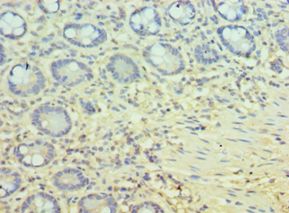 PPID / Cyclophilin D Antibody - Immunohistochemistry of paraffin-embedded human small intestine using antibody at 1:100 dilution.