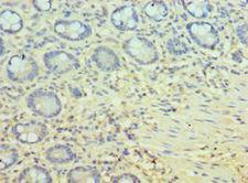 PPID / Cyclophilin D Antibody - Immunohistochemistry of paraffin-embedded human small intestine using antibody at 1:100 dilution.