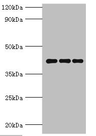 PPID / Cyclophilin D Antibody - Western blot All lanes: Peptidyl-prolyl cis-trans isomerase D antibody at 9µg/ml Lane 1: Mouse brain tissue Lane 2: A549 whole cell lysate Lane 3: MCF-7 whole cell lysate Secondary Goat polyclonal to rabbit IgG at 1/10000 dilution Predicted band size: 41 kDa Observed band size: 41 kDa