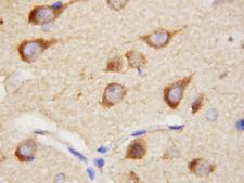 PPID / Cyclophilin D Antibody - PPID / Cyclophilin D antibody. IHC(P): Rat Brain Tissue.