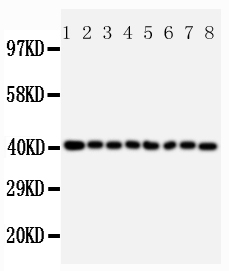 PPID / Cyclophilin D Antibody - Anti-PPID antibody, Western blotting Lane 1: Rat Brain Tissue LysateLane 2: Rat Pancreas Tissue LysateLane 3: Rat Liver Tissue LysateLane 4: JURKAT Cell LysateLane 5: RAJI Cell LysateLane 6: CEM Cell LysateLane 7: HL-60 Cell Lysate Lane 8: HT1080 Cell Lysate